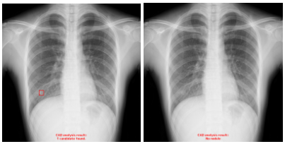 ※左：旧モデルによる解析結果，右：新モデルによる解析結果