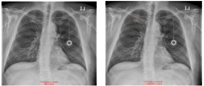 ※左：旧モデルによる解析結果，右：新モデルによる解析結果