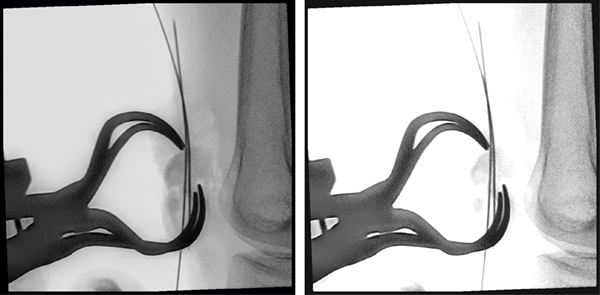 （左）MetalSmartあり（右）MetalSmartなし