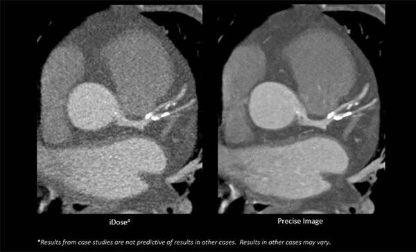 「Precise Image」使用前（左），使用後（右）