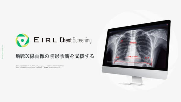 EIRL Chest Screening