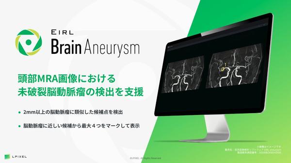 頭部MRA画像から脳動脈瘤候補点を検出するEIRL Brain Aneurysm，偽陽性の低減を実現した新モデルを発売