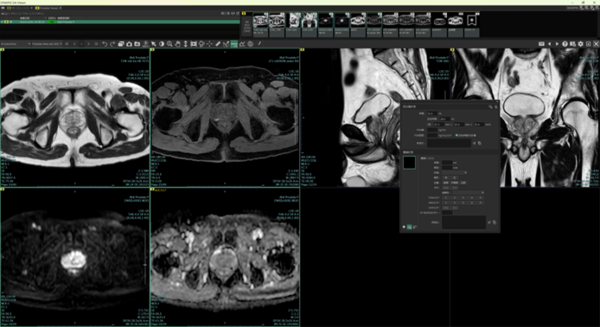 前立腺ビュー（MR）のレイアウトイメージ図