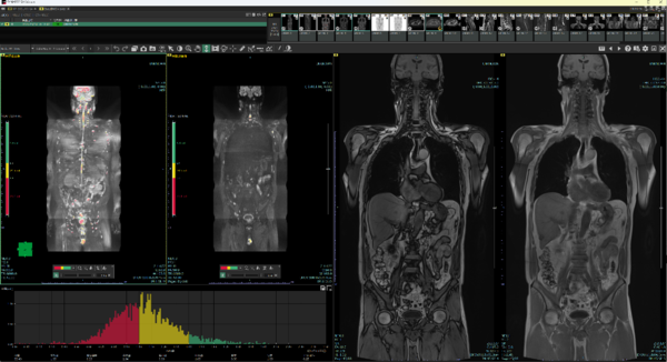 Body DWIビュー（MR）のレイアウト画面