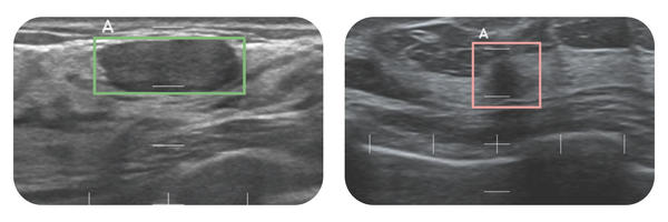 「スマートオピニオン METIS Eye」の検出結果イメージ