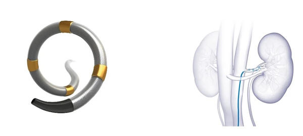 Symplicity Spyral 腎デナベーションシステム　医療機器承認番号：30700BZX00207000