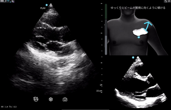 ※Cardiac Guidance/ Interpretationの実際の画面