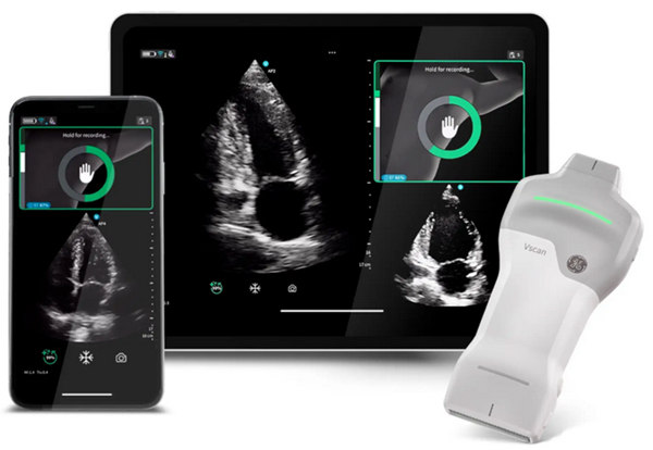 ※Cardiac Guidanceによる心エコー検査のリアルタイムガイド表示機能。Quality Meterで画像クオリティを確認，画面上部にはイラストとともに「時計回りにゆっくりと回転」などリアルタイムに様々なガイダンスが表示される。