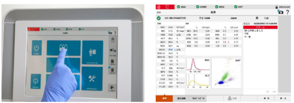 直感的なユーザーインターフェースと分かりやすい異常値表示・精度管理グラフで検査の効率化・標準化に貢献