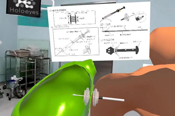 Holoeyes，内視鏡的胆嚢ドレナージ手技を学習できるXRコンテンツを制作