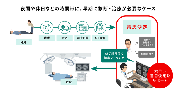医療現場での「頭部CT画像解析AIエンジン DoctorNET Heuron CTS」の活用イメージ