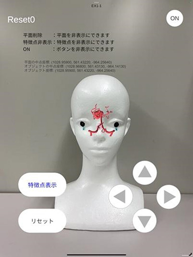 張ジョ 准教授（情報デザイン学科）が考案した頭部手術における患部提示アプリケーション