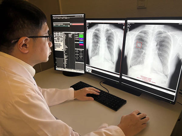 AIを活用した肺がん検診読影のイメージ