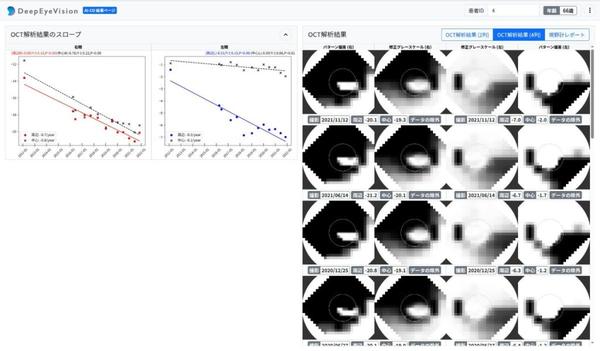 図1　OCT解析結果モードのイメージ