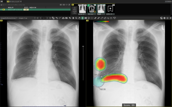 左：オリジナル画像／右：解析画像