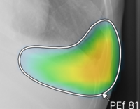 ヒートマップと輪郭の併用表示