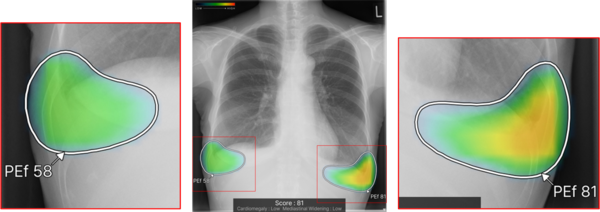所見名／スコア表示