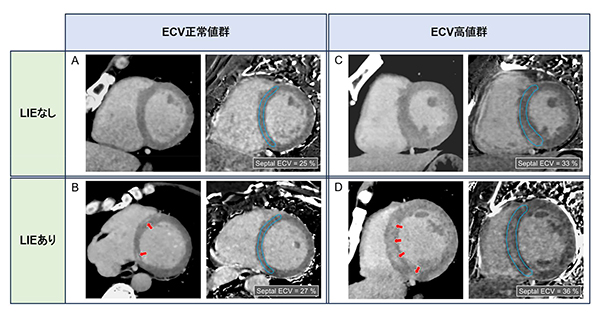 図1. LIE及びECVの組み合わせ