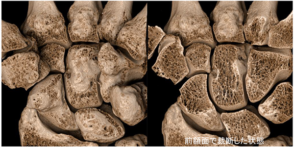 図 4： 本装置の開発と並行して開発した写実的3次元画像生成法による画像