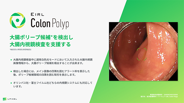 EIRL Colon Polyp