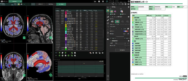 正常脳*3との比較定量化画面・レポート