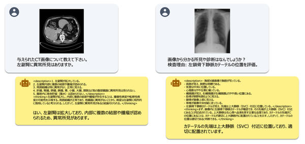 図1：開発した医療マルチモーダルモデルの出力例