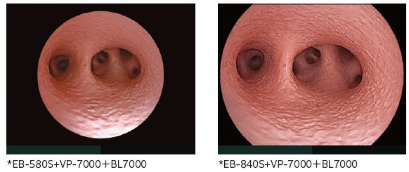 HDイメージCMOSセンサー搭載による高精細な内視鏡映像を実現