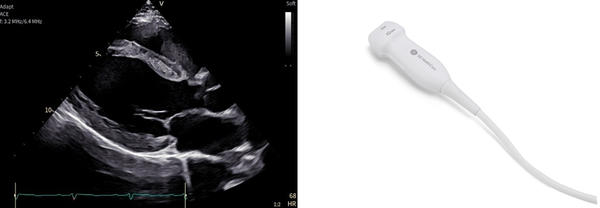 広帯域の周波数を用いたプローブ