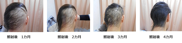 安全性に関する観察結果