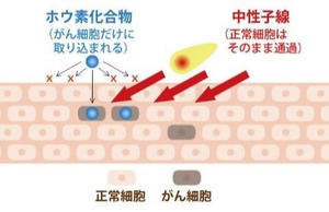 BNCTのメカニズム