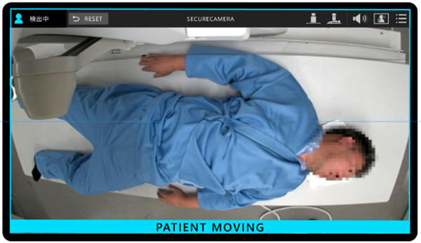 カメラで被検者の動きを検知した際のアラート画面