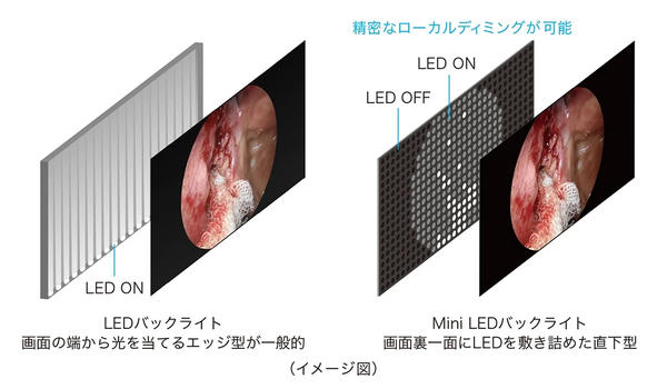 Mini LED×ローカルディミング×EIZO独自のアルゴリズムにより、高輝度・高コントラストを実現