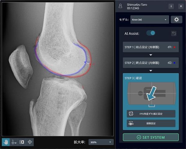 位置補正用画像解析ソフトウェア「Ortho-Navi」の画面 矢印でＸ線管保持器が移動する方向を示している