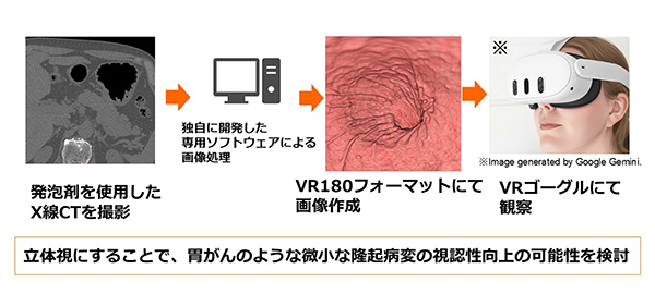 図1．写実的仮想胃内視鏡（Photo-realistic virtual gastroscopy：PRVG）によるバーチャルリアリティ（virtual reality：VR）胃検査システムの概要