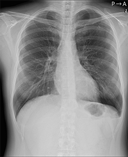 オリジナル画像