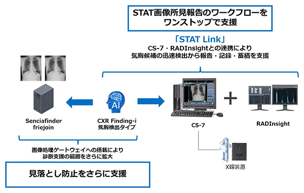 STAT Linkeのイメージ図