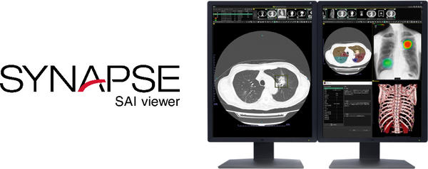 標準ビューワに「SYNAPSE SAI viewer」を採用し、画像診断ワークフローの効率化を支援