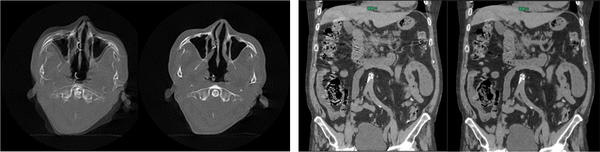 Body StillShot2（各　左：処理前　右： 処理後）