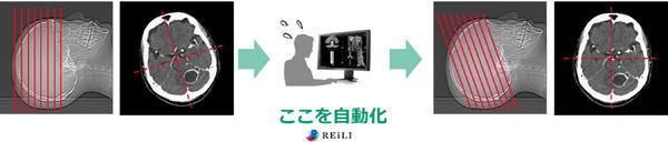 後処理：自動断面設定機能