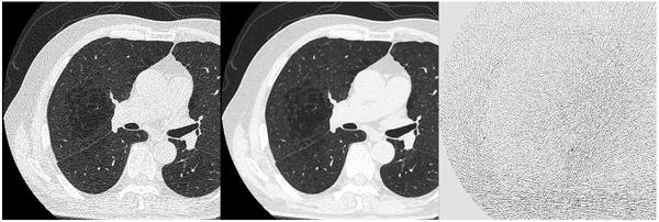 DLR Focus（左：処理前　中：処理後　右：処理前後の差分） 処理前後の差分画像から，断面の構造を保ったままノイズだけが除去されていることが分かる。