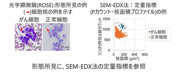 図1　 ROSEへの応用を想定し，SEM-EDX法で得た定量指標「Pカウント・核面積プロファイル」（右）と，細胞診画像（左）をセットで参照する例（がん細胞は核が大きく，核内の染色が濃いことが特徴）