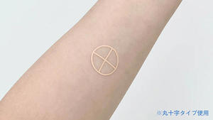 放射線治療用ガイドマーカーシール