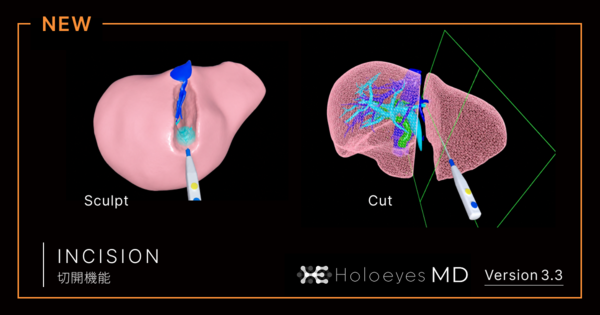Holoeyes MD
