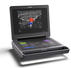 Sonosite MT