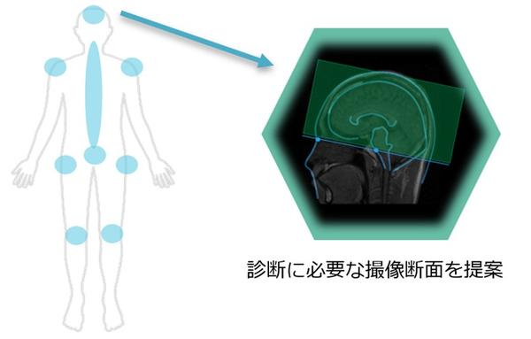 頭部，脊椎，四肢関節，股関節，骨盤にて 撮像する断面画像の位置・角度を自動で設定