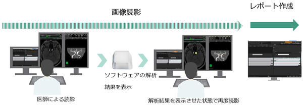 医師がセカンドリード型のソフトウェアによる解析結果を用いて読影を行う様子