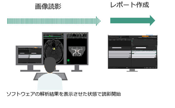 医師がコンカレントリード型のソフトウェアによる解析結果を用いて読影を行う様子