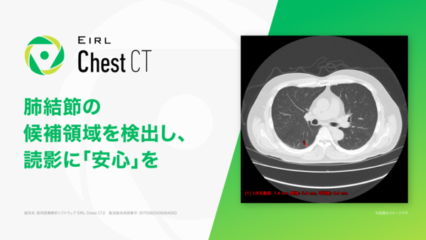 EIRL Chest CT