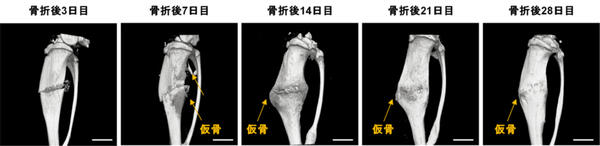 図1: 骨折後の時間経過に伴う仮骨形成と骨の再構築