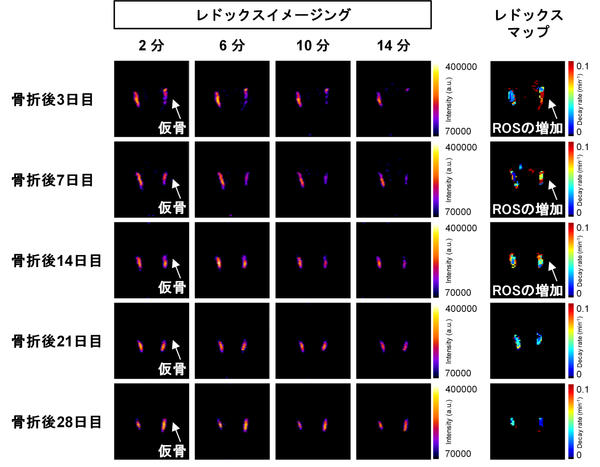 図2: DNP-MRIによって捉えた骨折治癒に伴うレドックス動態